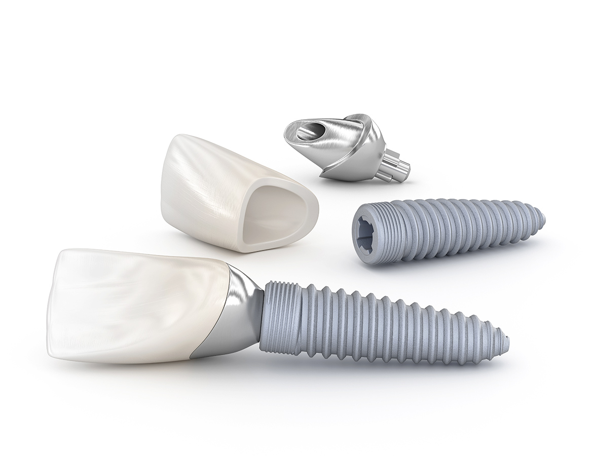 Dental Grade 4 Bars Dental Grade 4 Bars